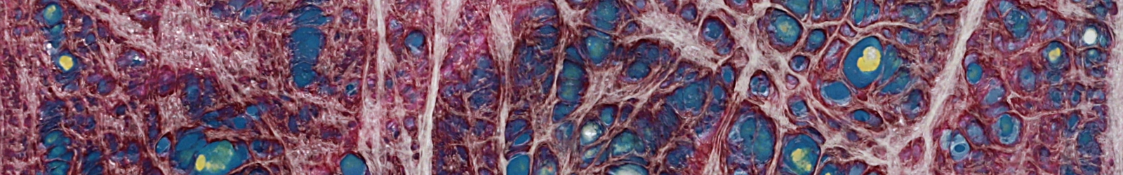 Ausschnitt eines Bildes, auf dem geschmolzene, farbige Folien eine Art Netzstruktur bilden, wie von einem menschlichen Gewebe. | konzeptdesignkunst